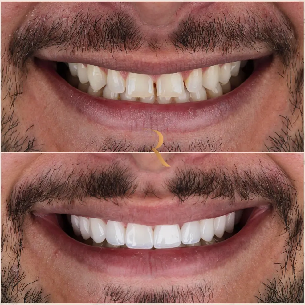 WhatsApp Image 2025-05-27 at 14.08.00