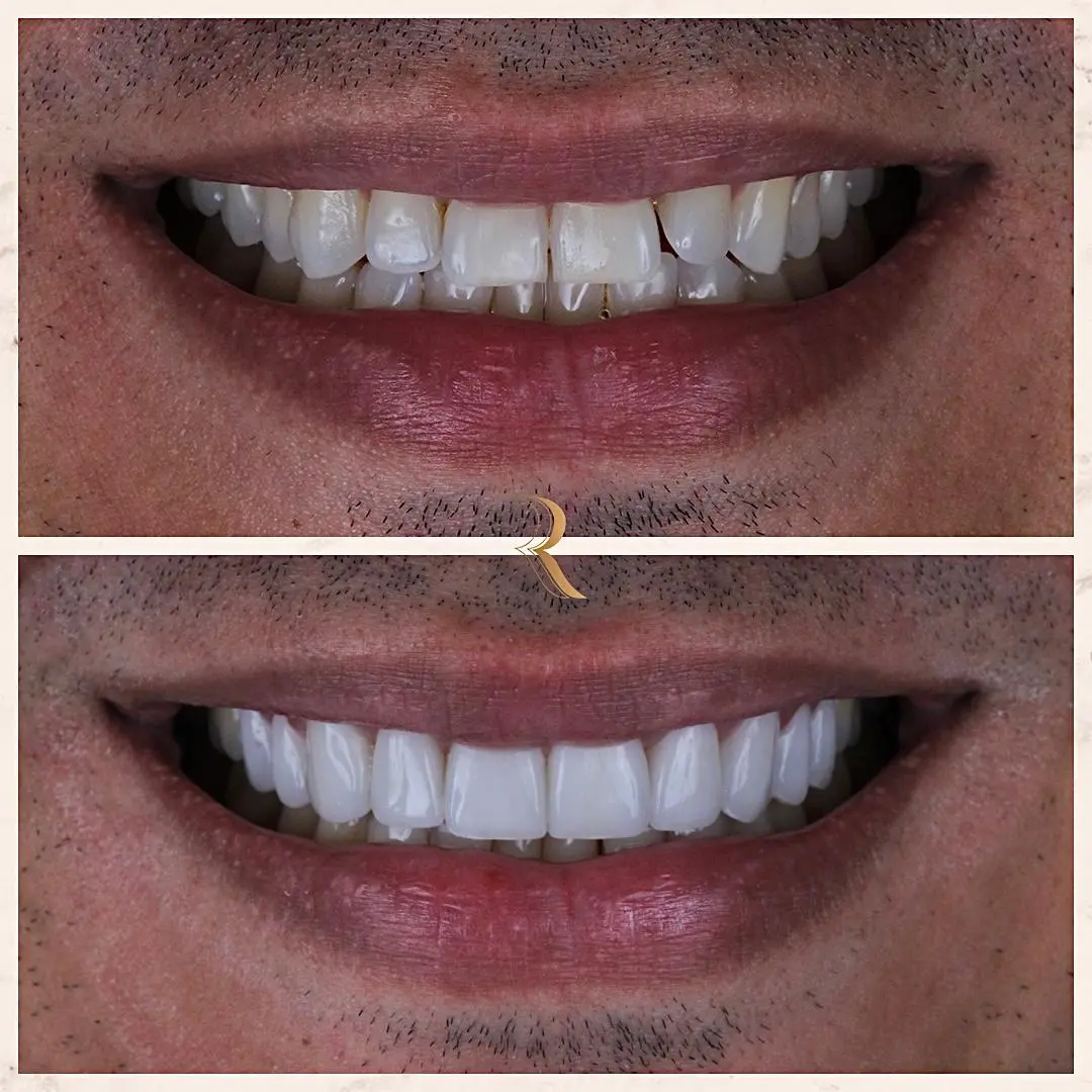 WhatsApp Image 2025-05-27 at 14.18.18