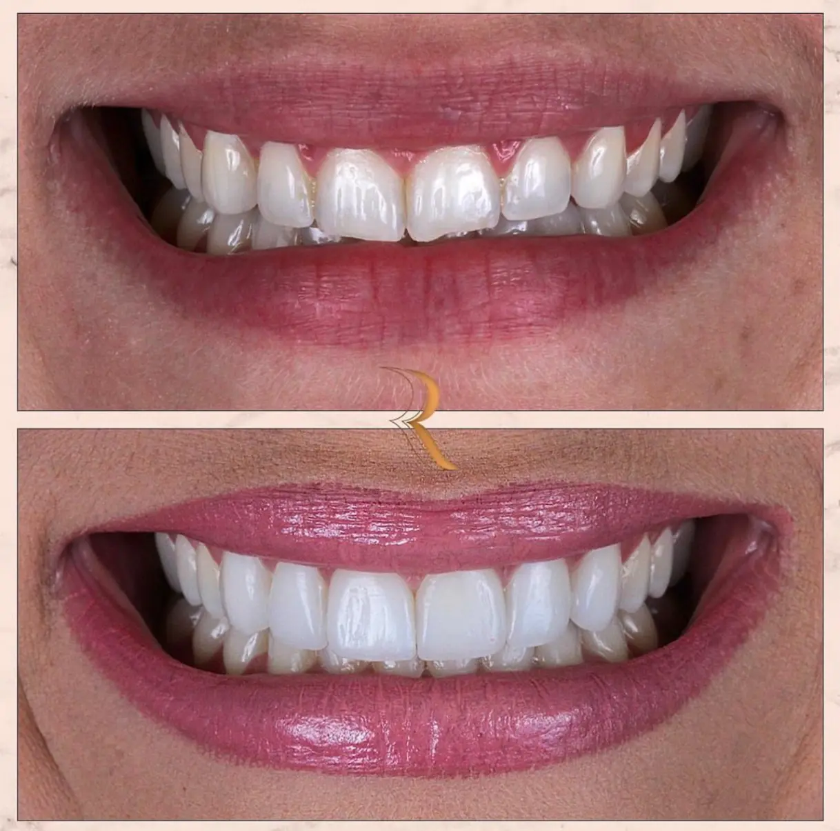 WhatsApp Image 2025-05-27 at 14.39.30