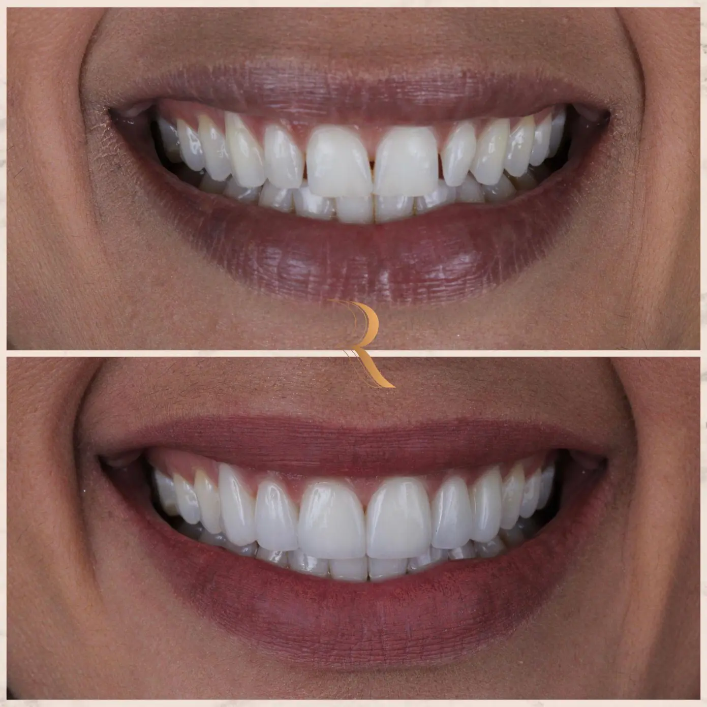 WhatsApp Image 2025-05-27 at 14.40.10