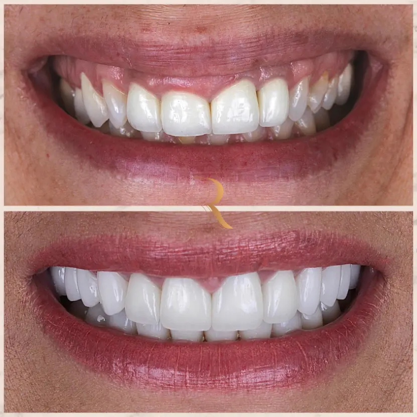 WhatsApp Image 2025-05-27 at 14.40.11