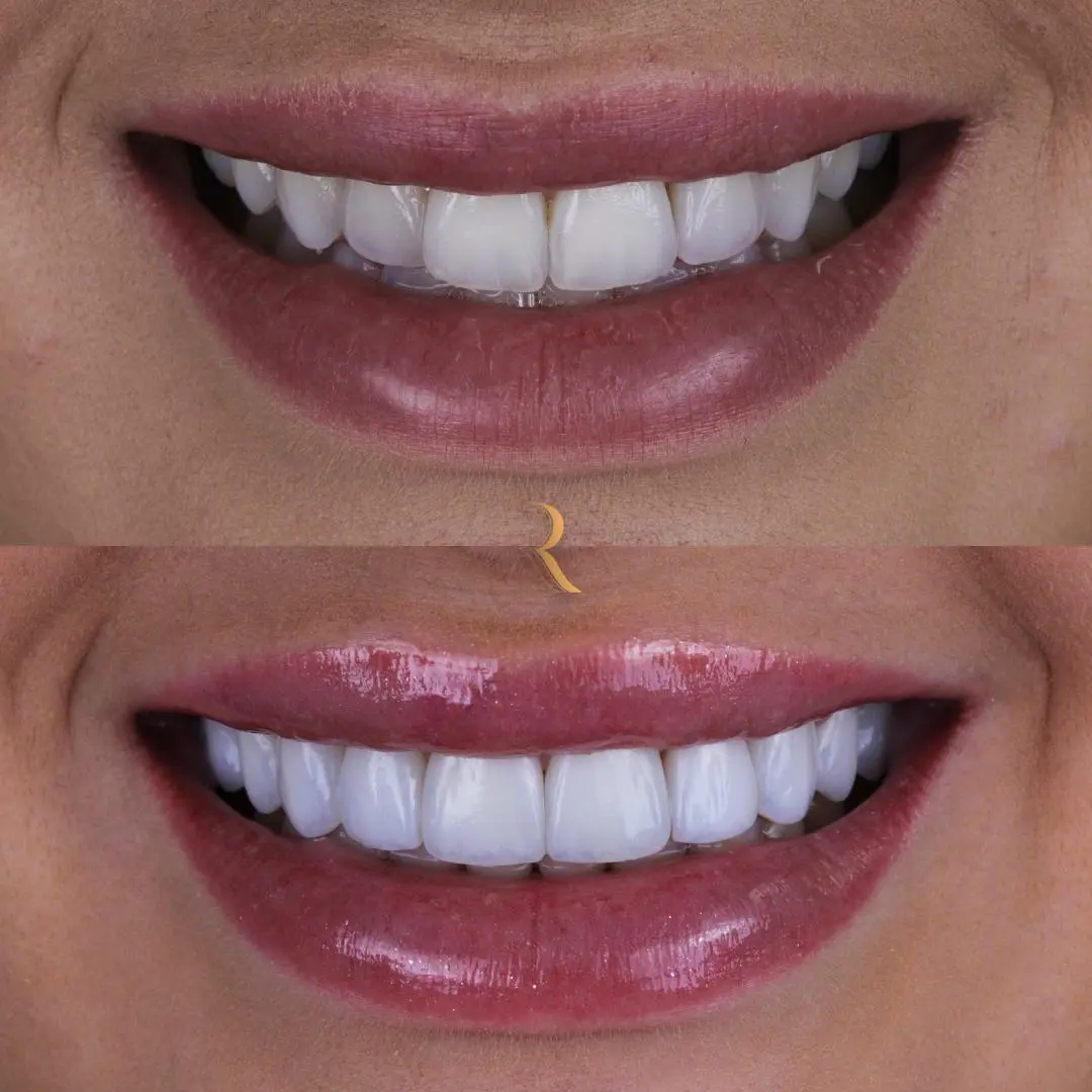 WhatsApp Image 2025-05-27 at 14.40.25